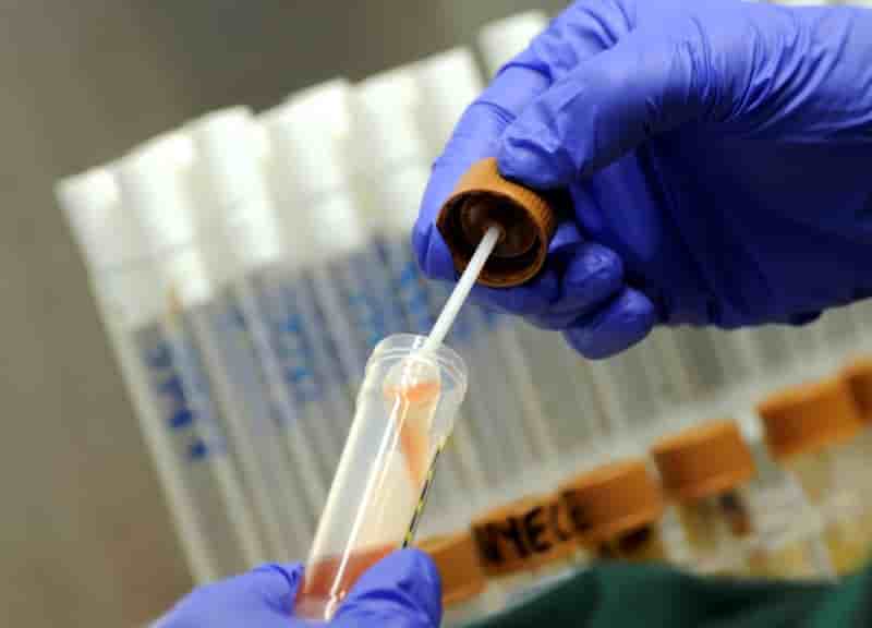 Premier cas de bacterie ultraresistante signale aux usa