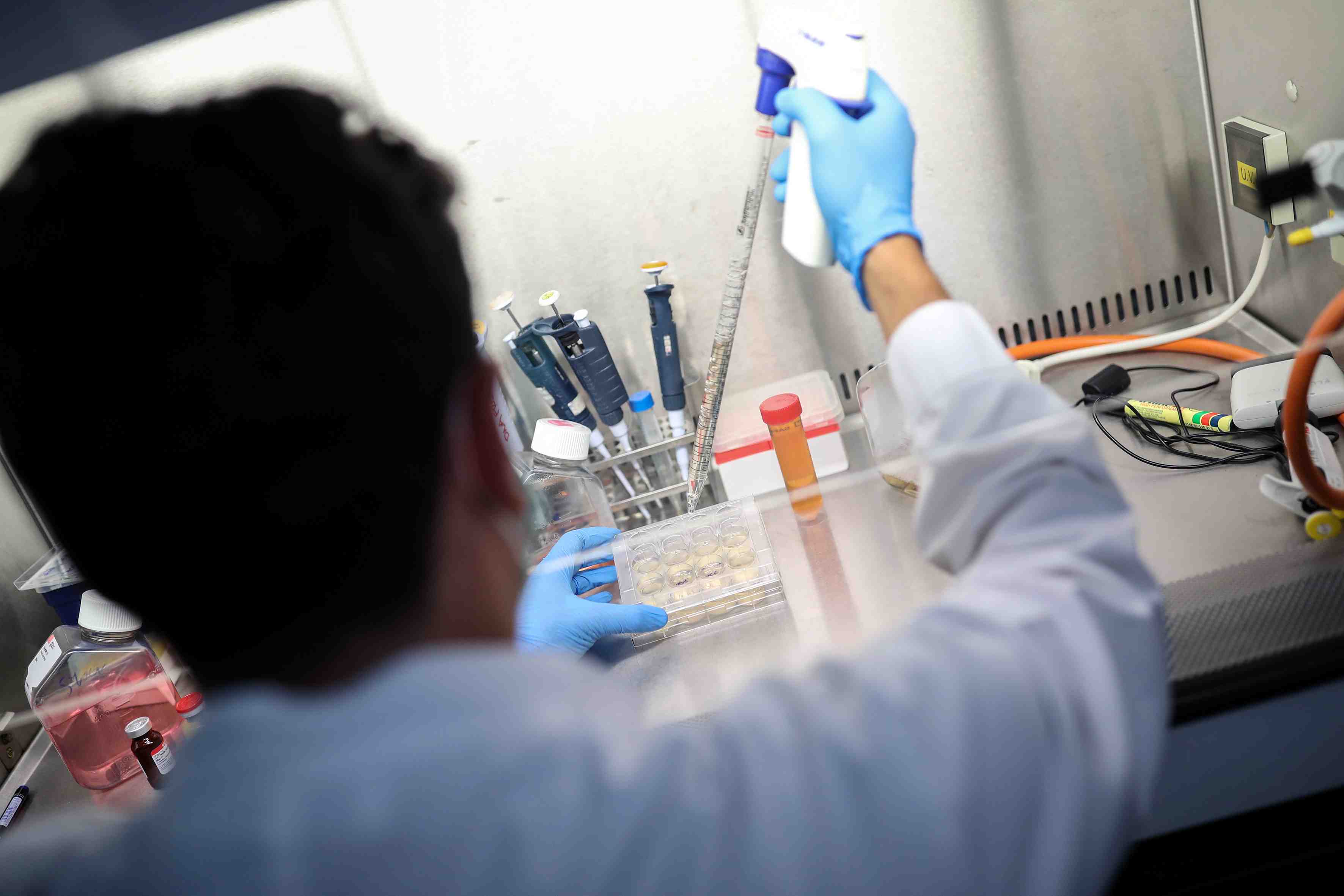 Coronavirus: novacyt va etendre sa gamme de tests