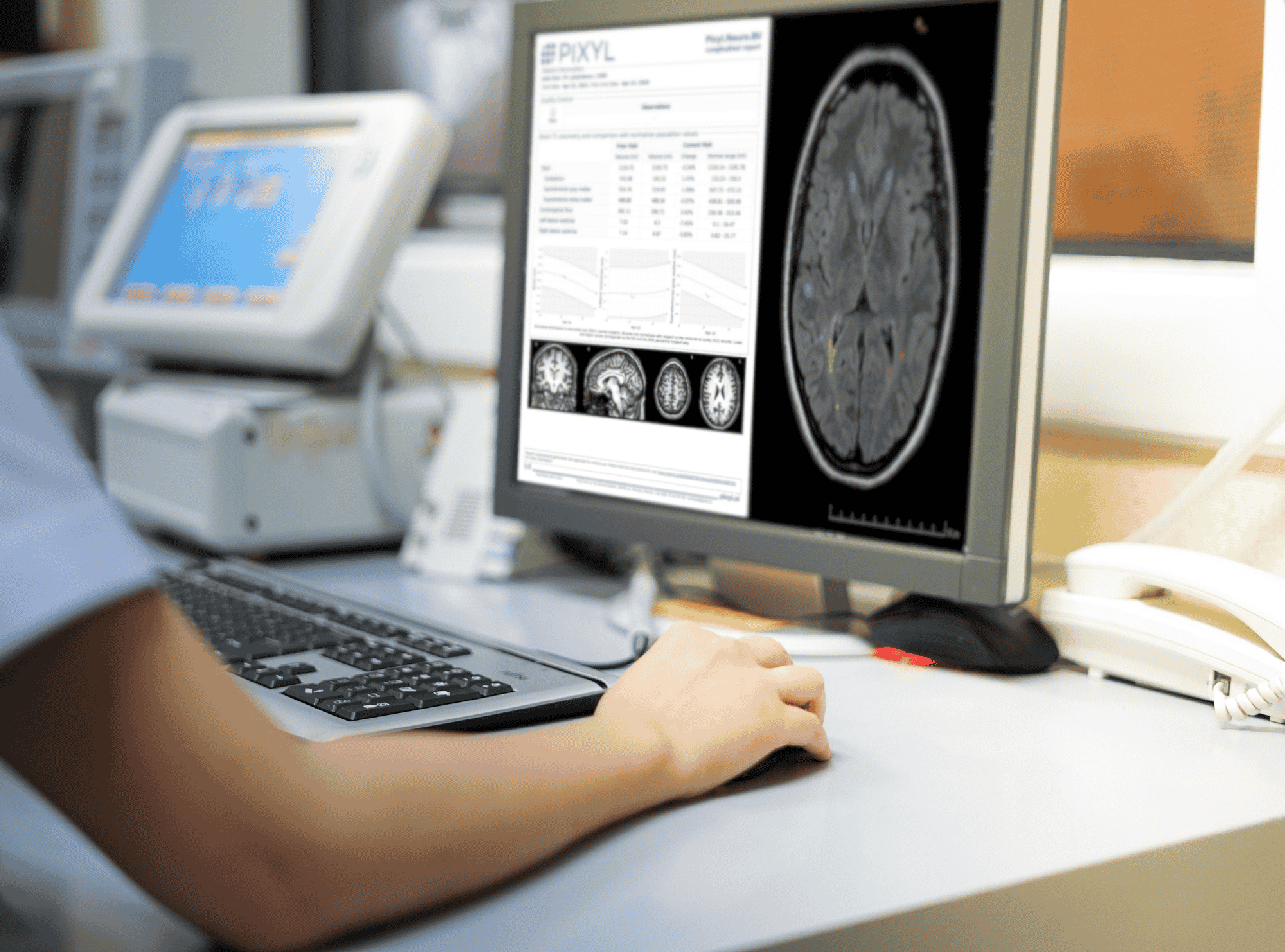 Pixyl radiologie IA