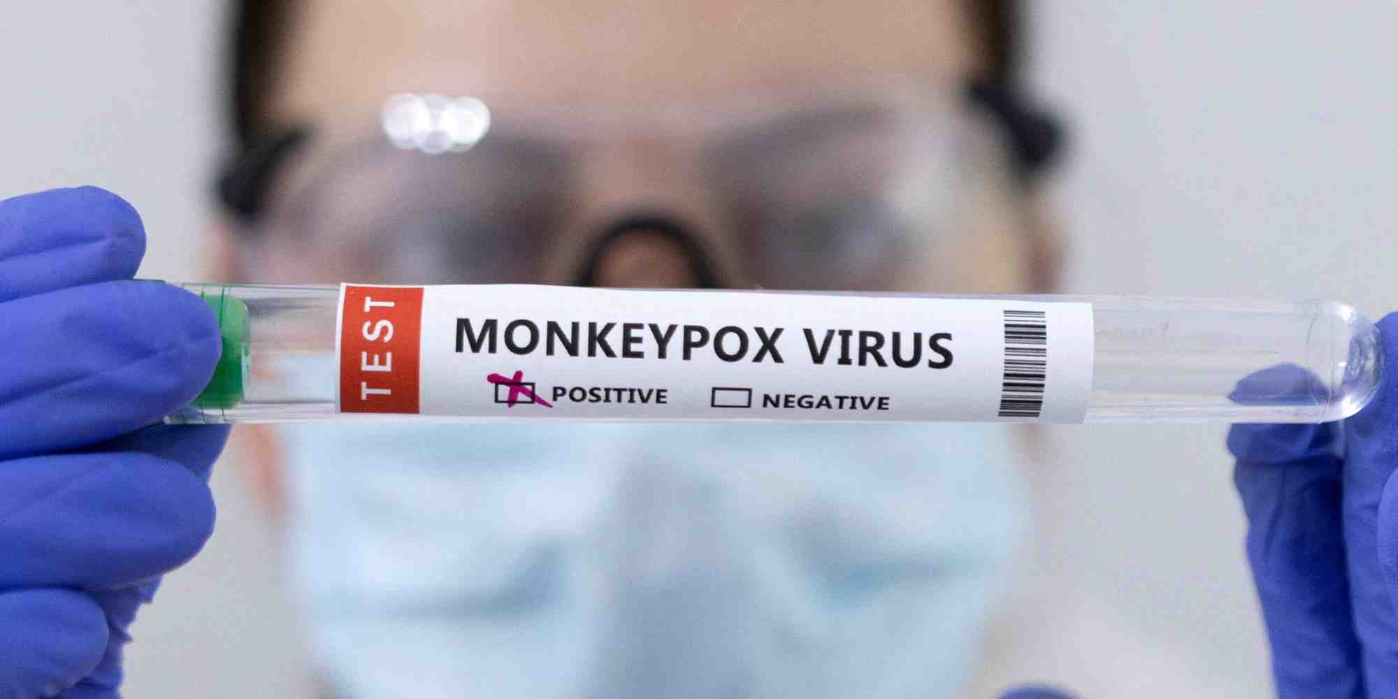 Le mpox se manifeste principalement par une forte fièvre et l'apparition de lésions cutanées, dites vésicules.