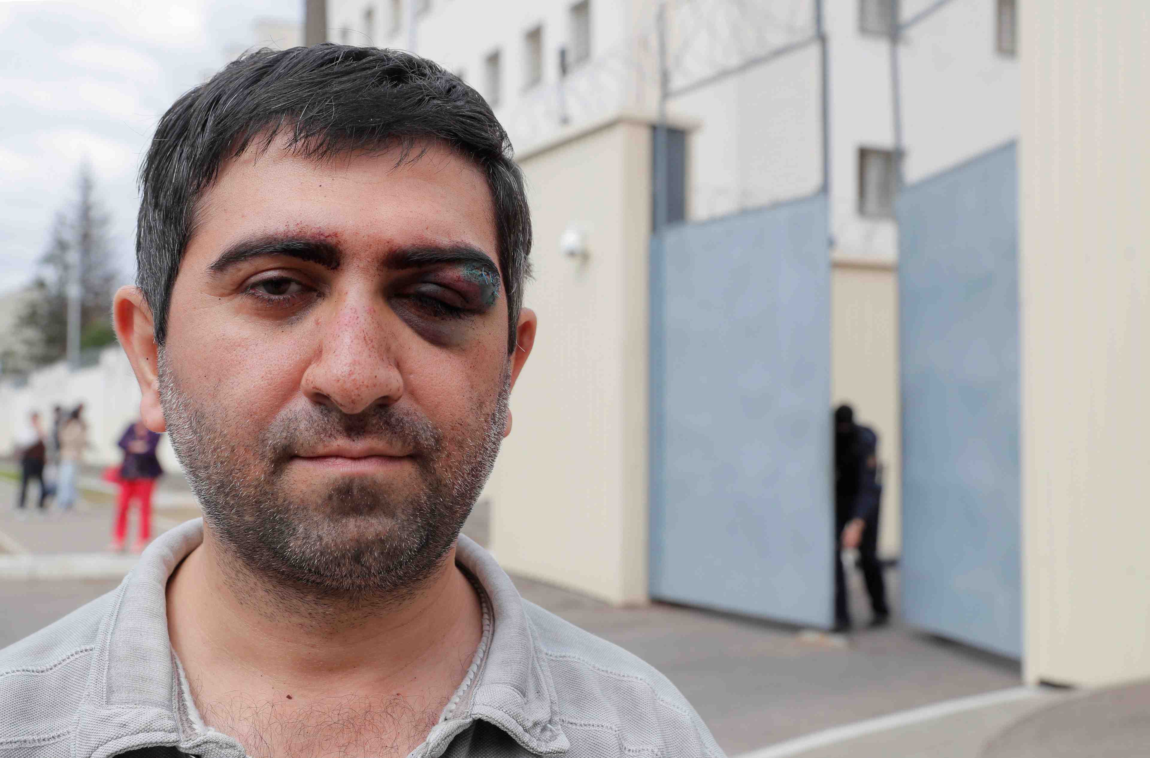 Bielorussie: des manifestants disent avoir ete frappes en prison