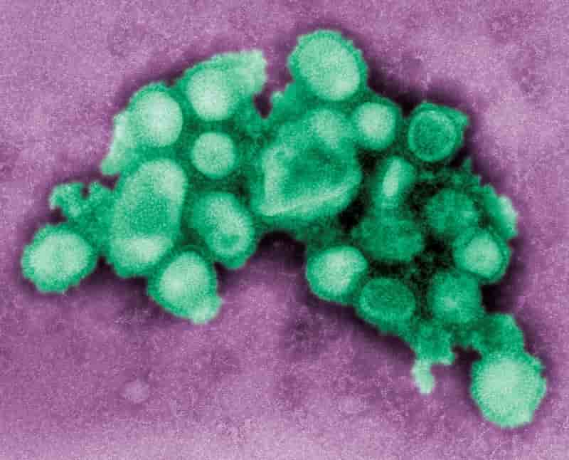 Plusieurs deces lies a la grippe h1n1 en armenie et en georgie