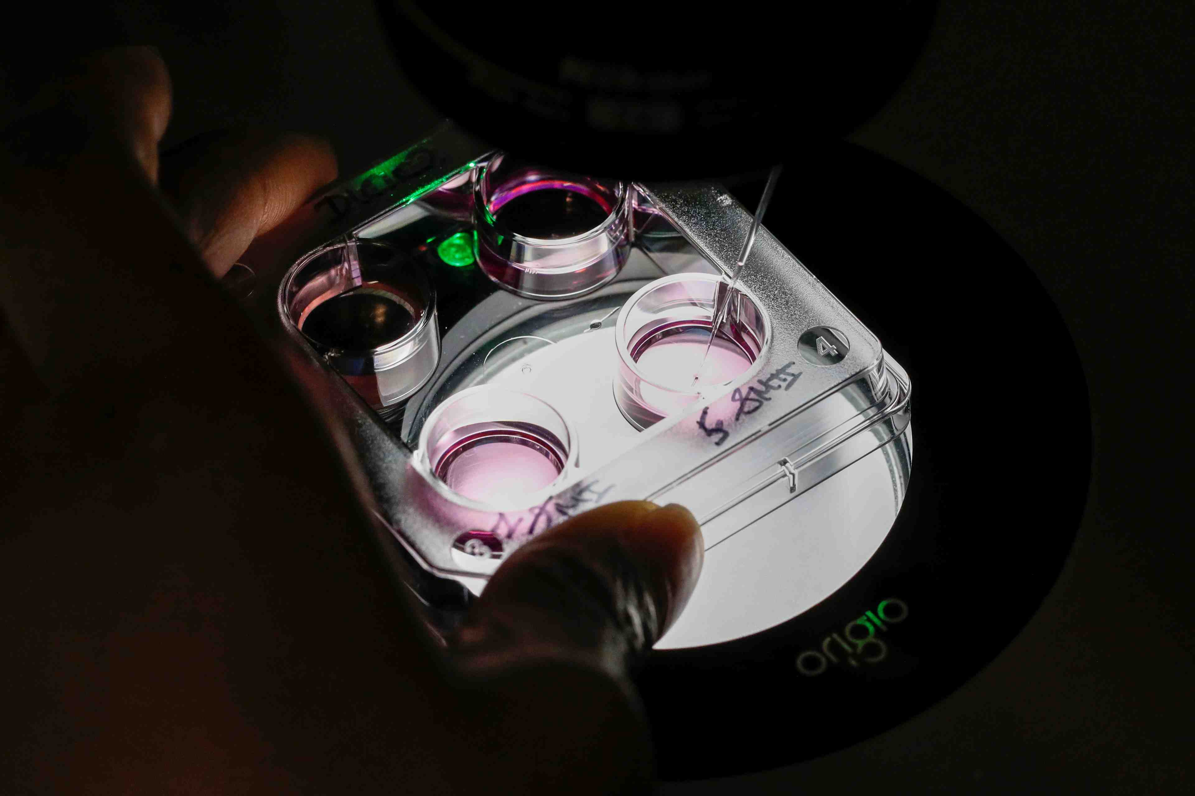 Biomerieux chute en bourse, deception sur l'operationnel et les previsions