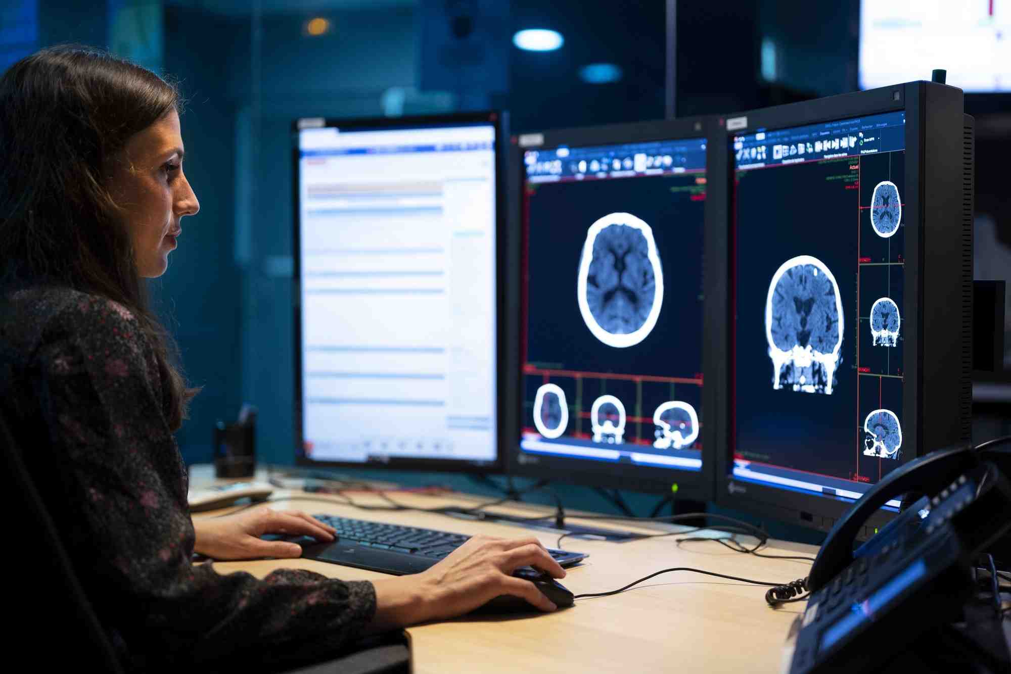 Alors que l'offensive des investisseurs privés dans la radiologie s'accélère, Imadis veut préserver son indépendance en ouvrant son capital aux radiologues.