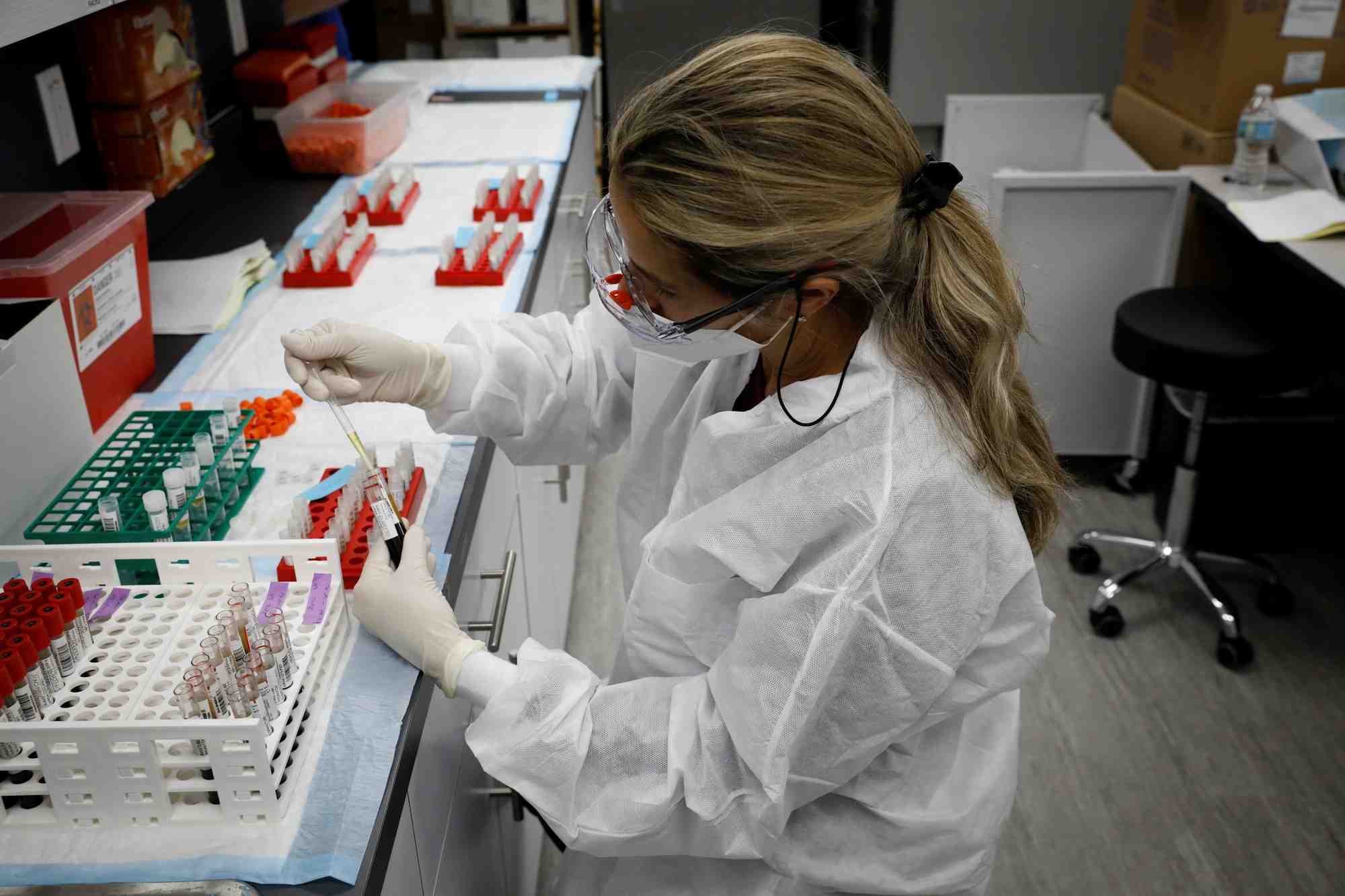 Les syndicats de biologistes alertent aussi sur le risque de disparition de réseaux de laboratoires de proximité, particulièrement dans les zones rurales.