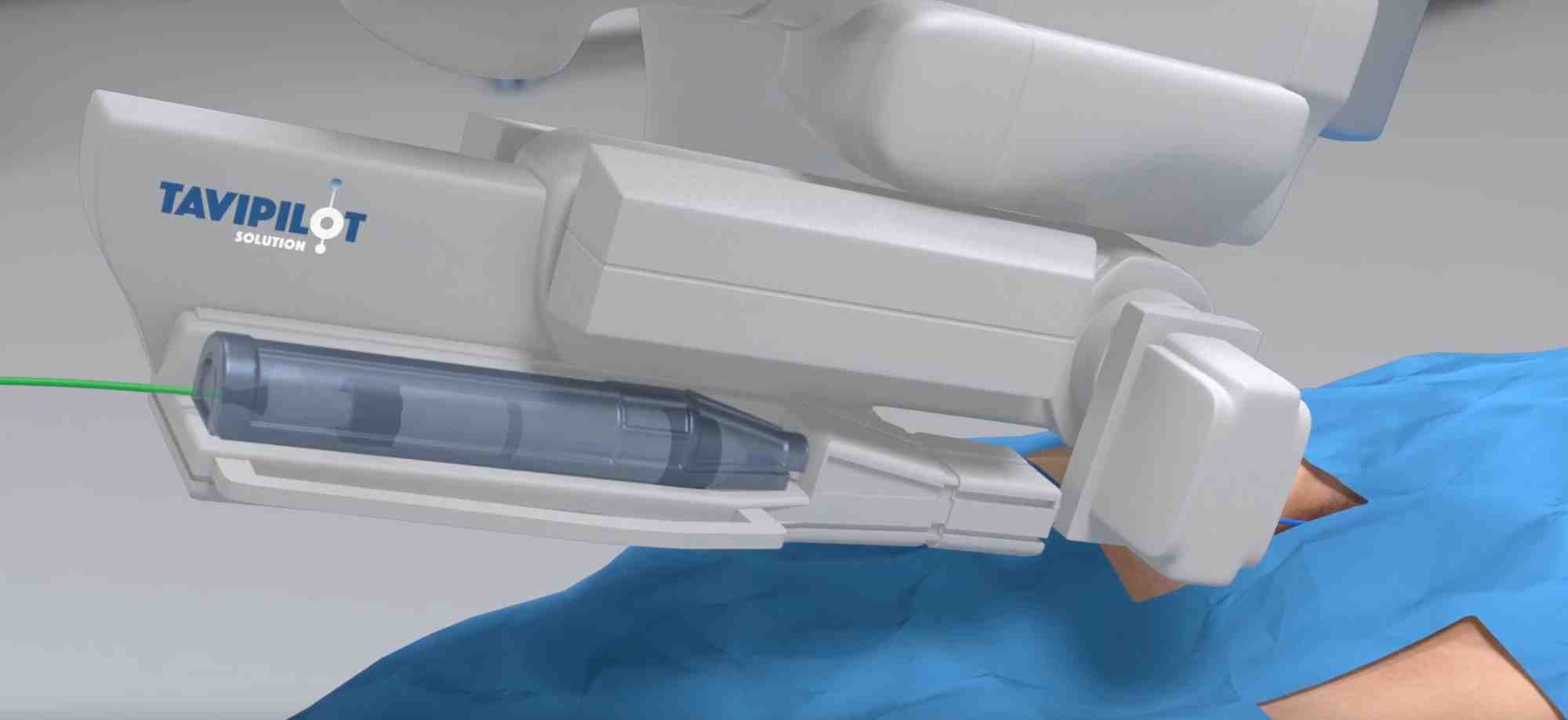 Spécialiste de la robotique chirurgicale, la medtech basée à Nice vient de soumettre son logiciel de guidage opératoire à la FDA .