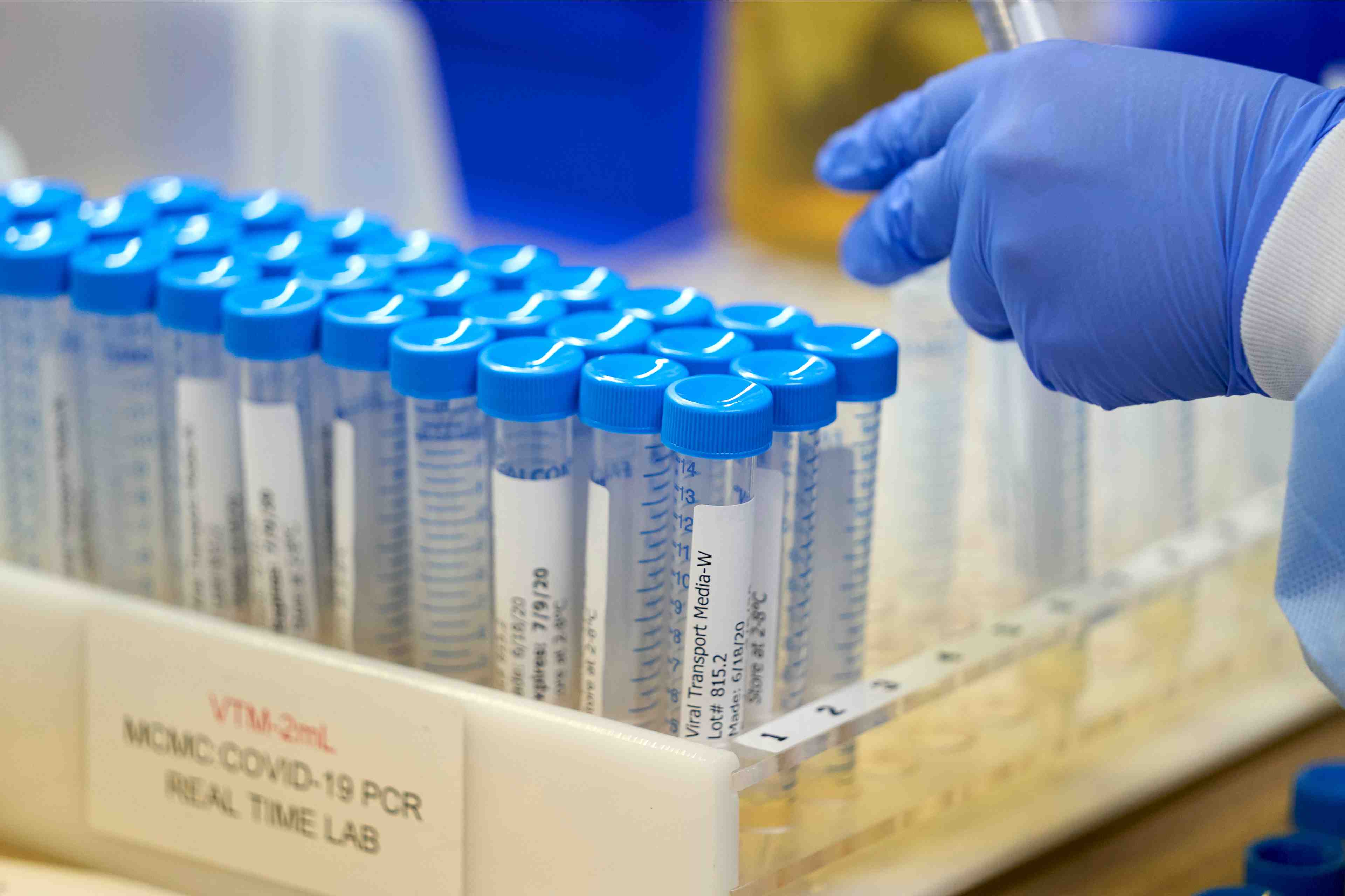Le coronavirus renforce l'autoritarisme et menace la democratie