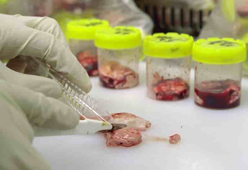 Un cas d’encephalopathie spongiforme bovine soupconne dans les ardennes