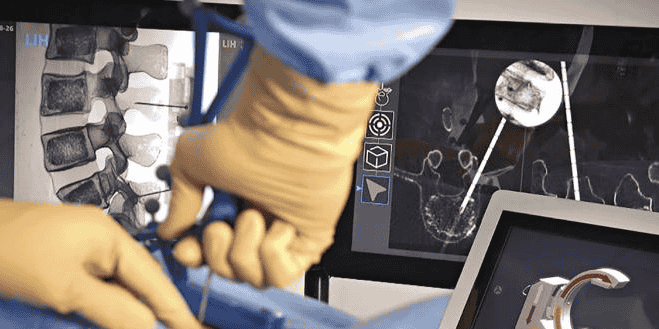 Surgivisio Ecential Robotics