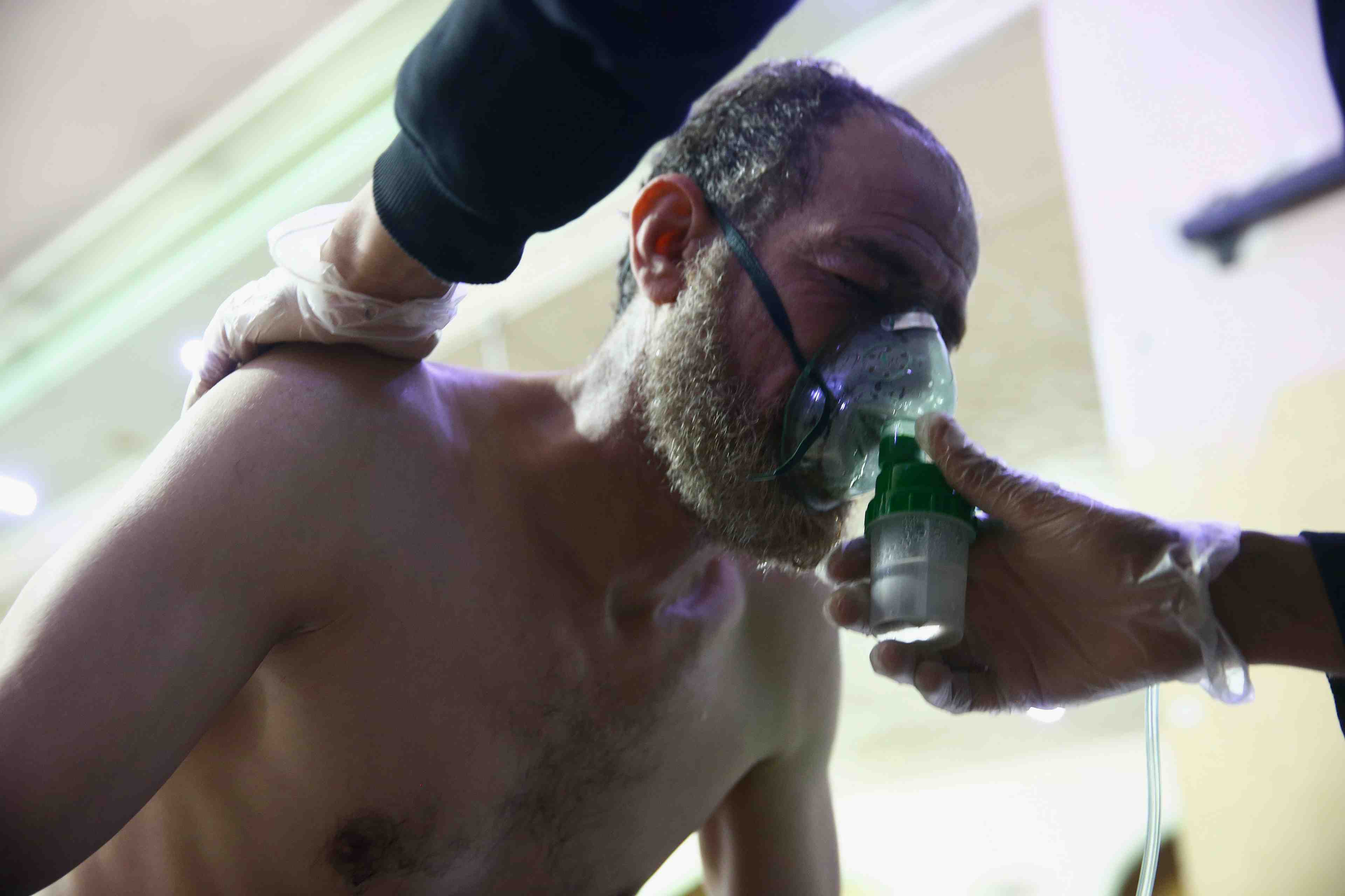 Symptomes evoquant une utilisation de chlore dans la ghouta orientale