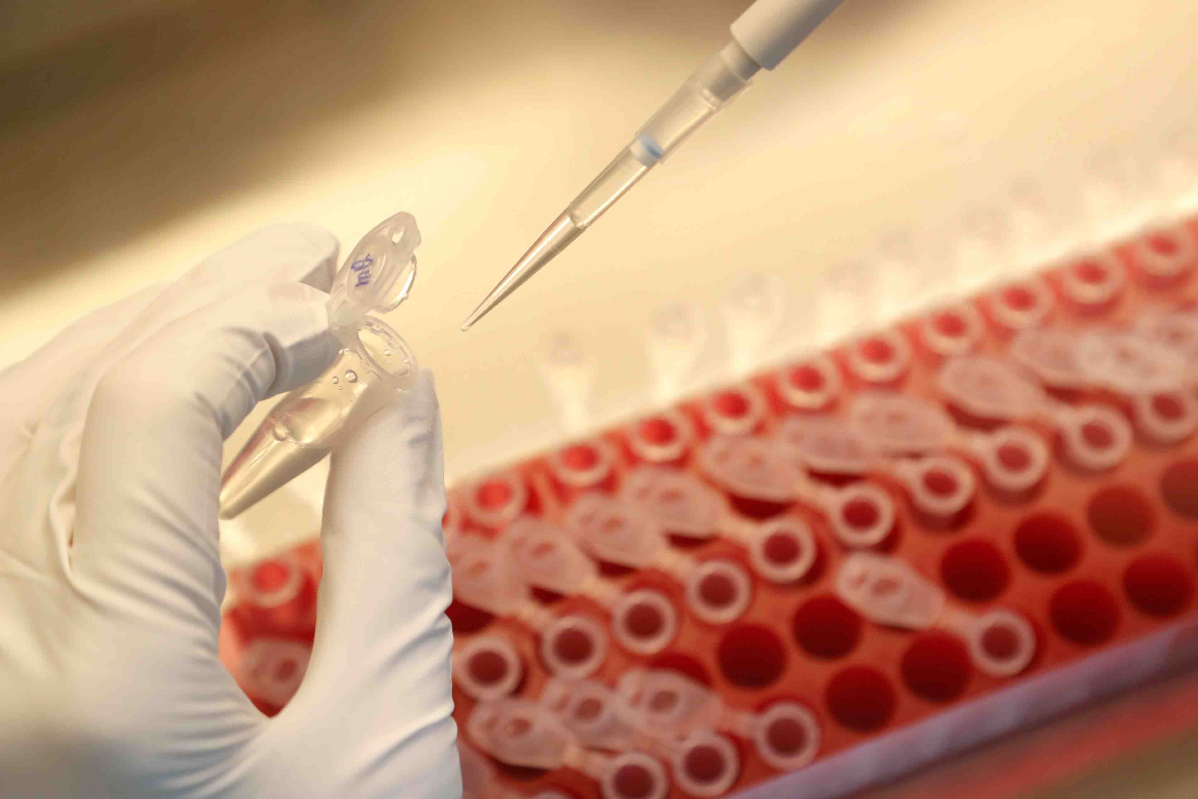 Pas de vaccination generalisee contre le coronavirus avant mi-2021, selon l'oms