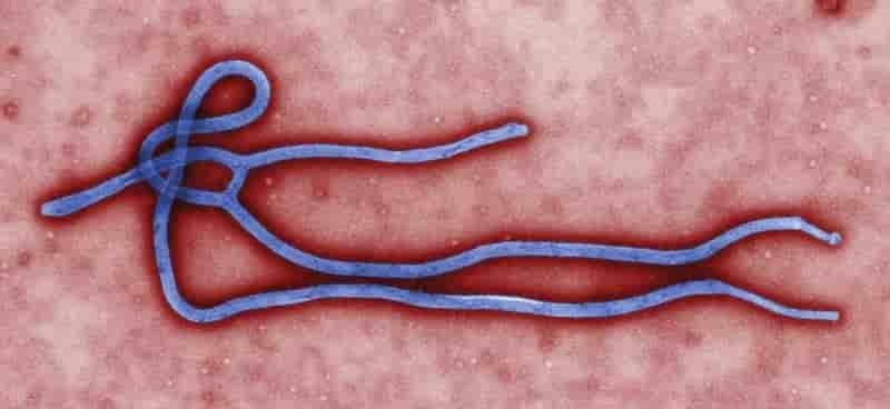 Suspicion de cas d'Ebola à Cergy-Pontoise