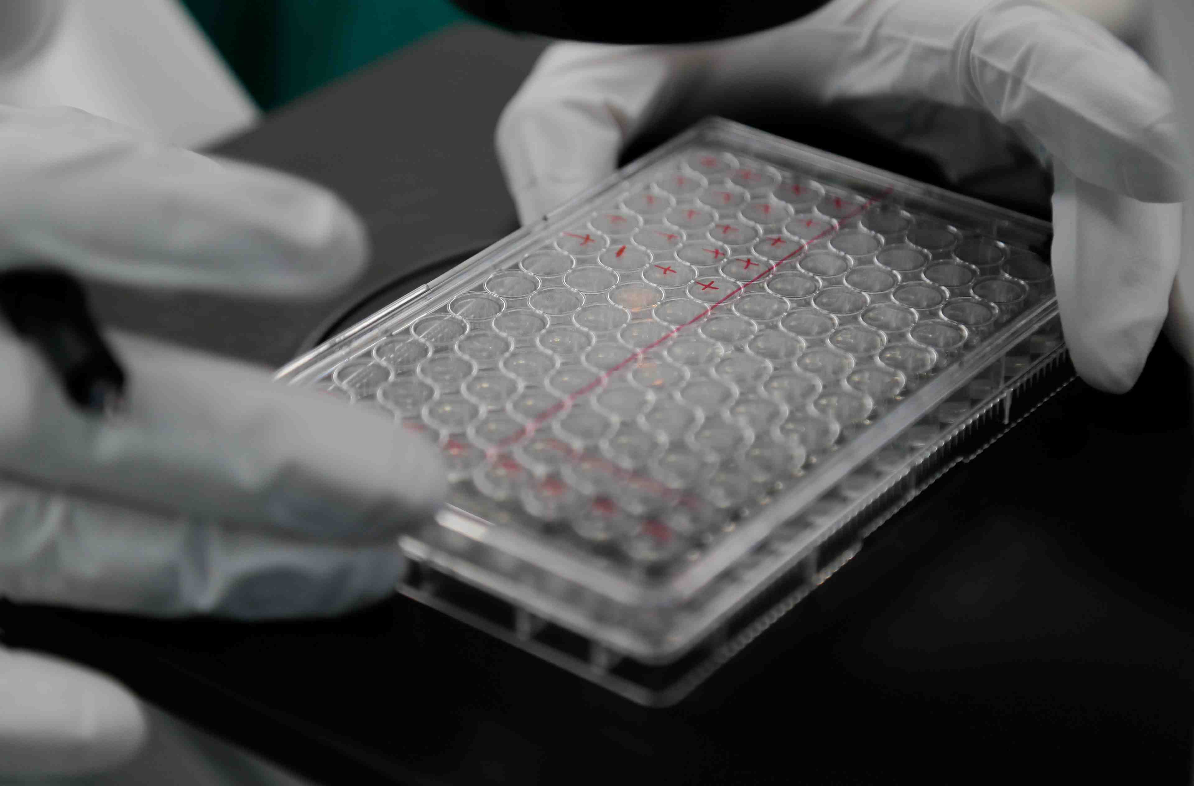 Coronavirus: le bilan depasse les 3.000 morts en russie