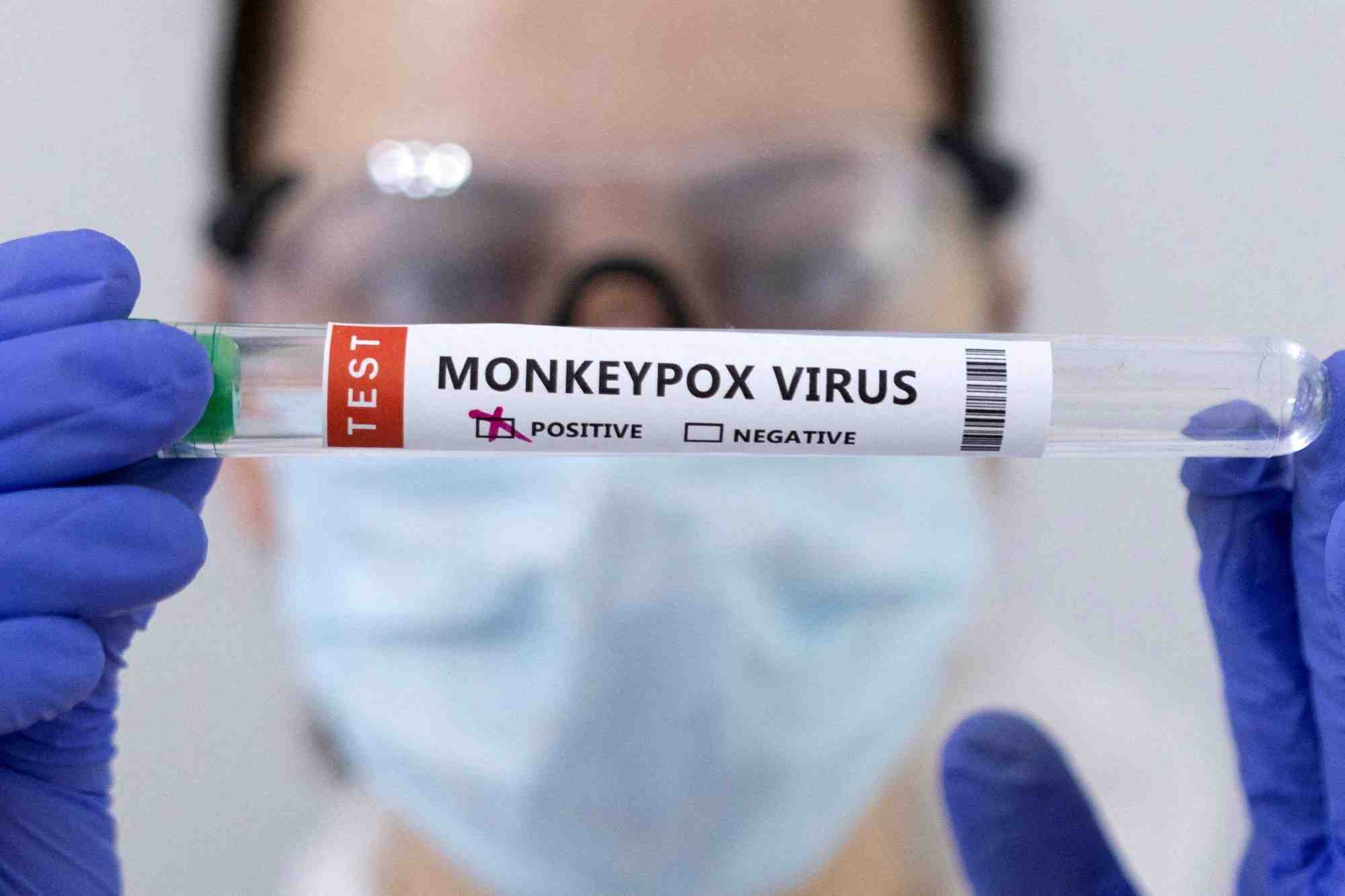 En tout, au moins 16 pays du continent, sur 55, ont déjà enregistré des cas de cette nouvelle souche de Mpox, découverte en septembre 2023.