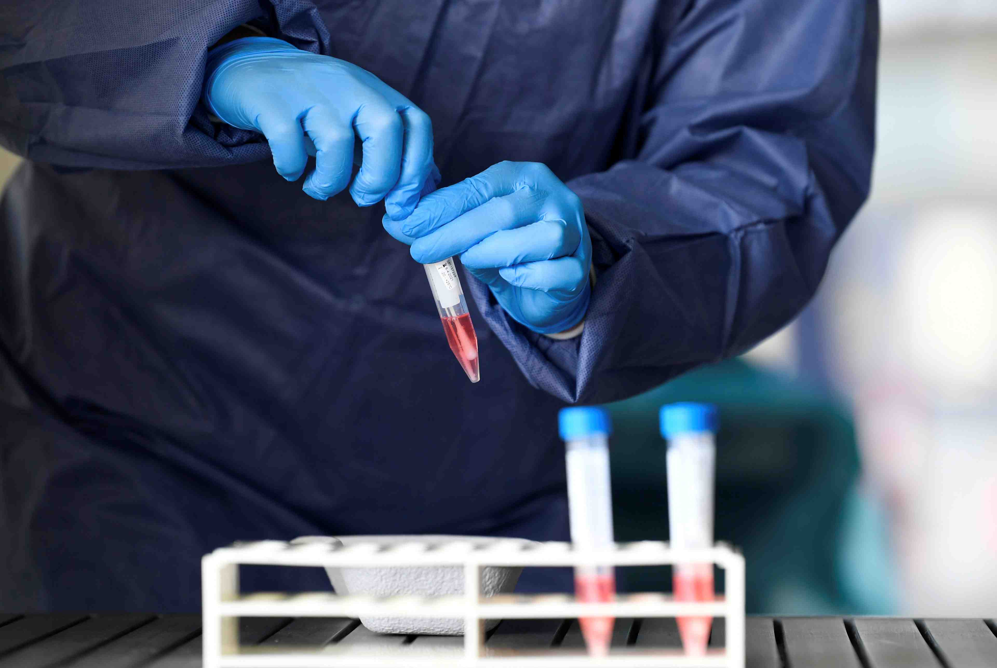 Coronavirus: plus de 1.200 morts et 21.000 cas aux pays-bas