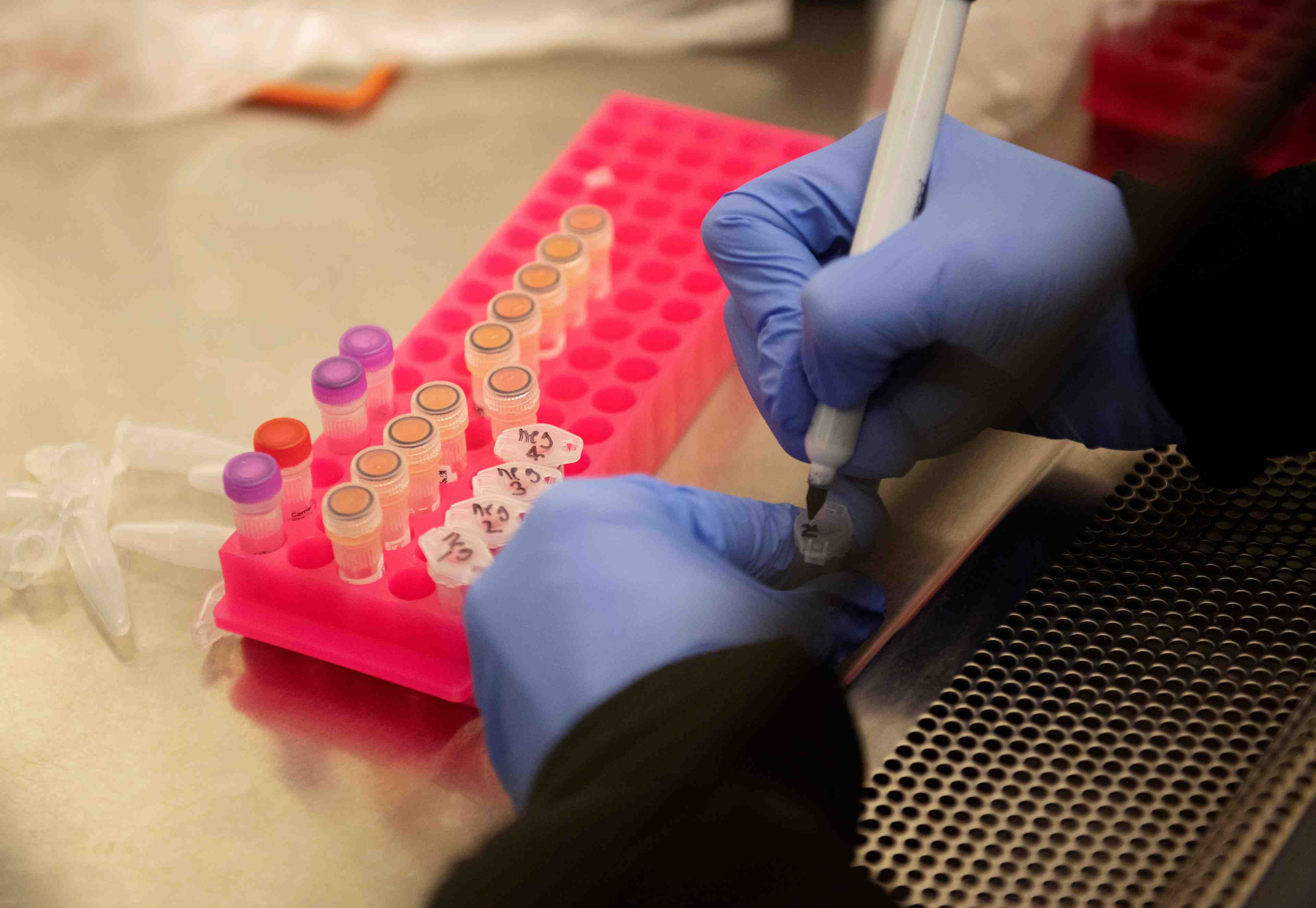 Coronavirus: une etude americaine infirme l'efficacite de l'hydroxychloroquine