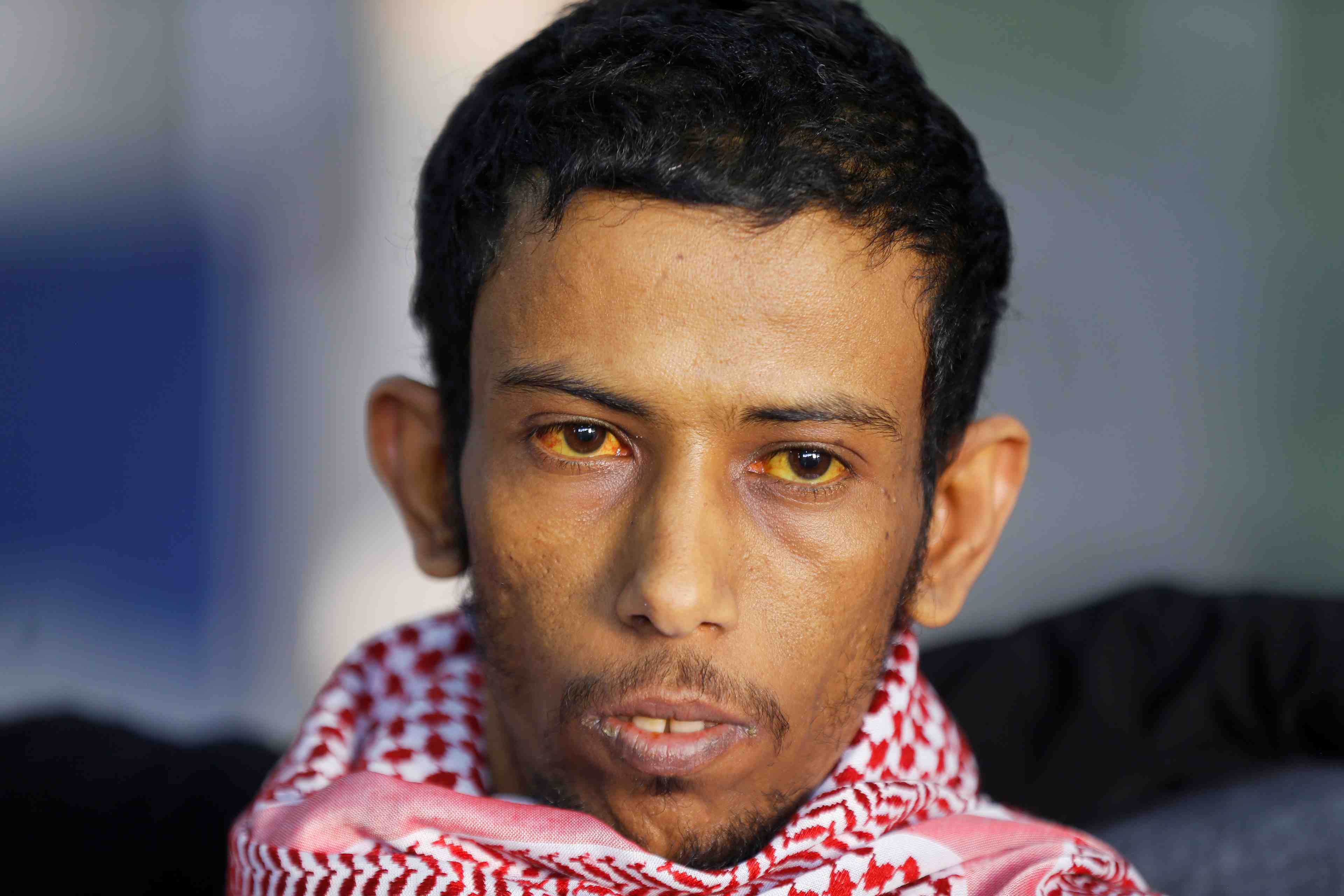 Yemen: echange de prisonniers entre ryad et les houthis