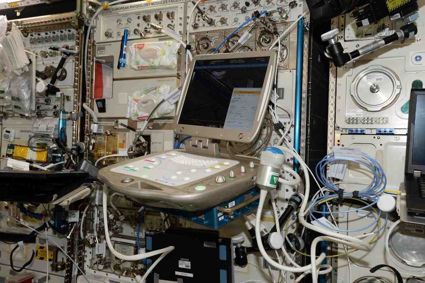 L'expérience Echo installée à bord du laboratoire Columbus de l'ISS.