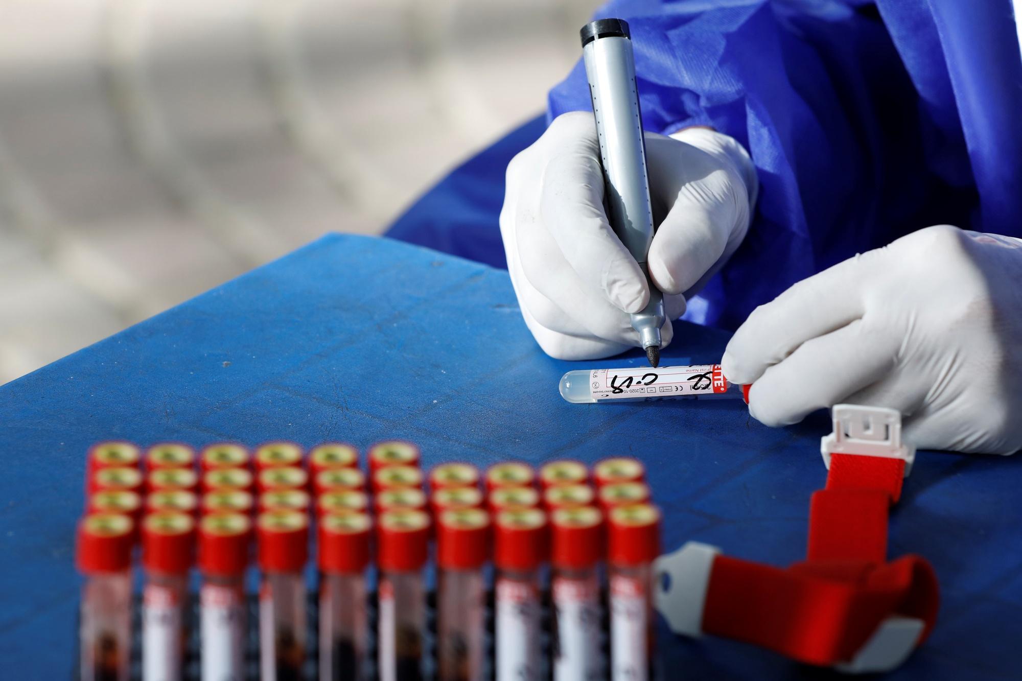 2 millions, c'est le nombre de tests sérologiques rapides de dépistage produits à partir de cet été.
