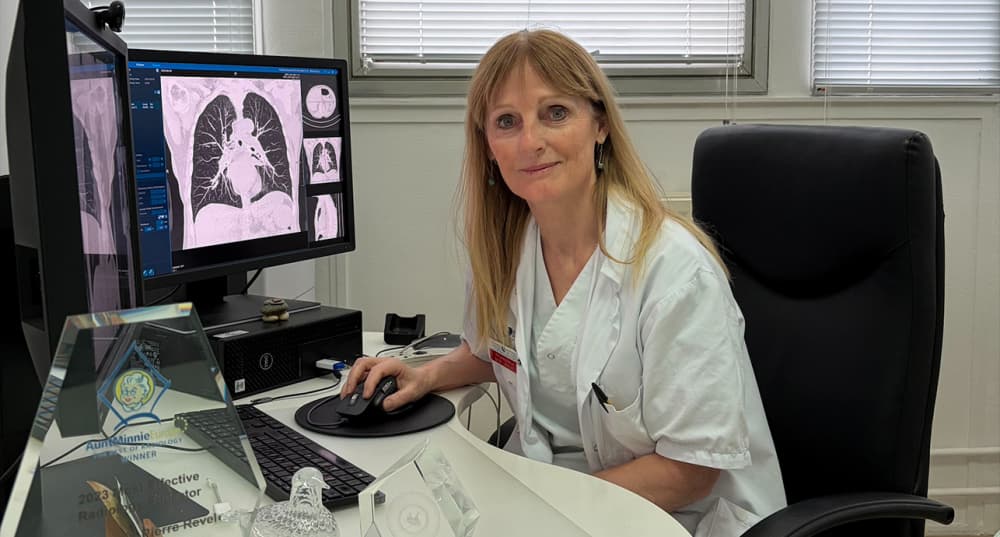 Professeure en radiologie à l’Université de Paris-Cité, Marie-Pierre Revel, guérie d’un cancer du poumon grâce à un dépistage précoce.