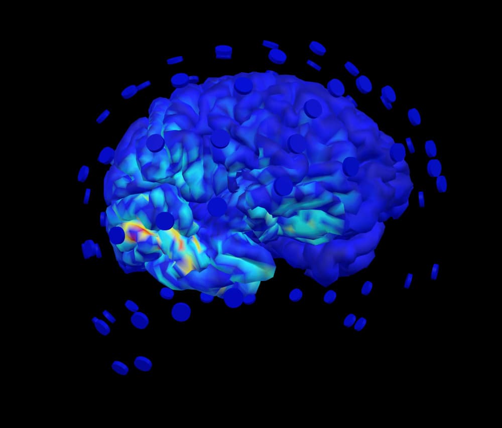 VB-Tech développe un jumeau virtuel personnalisé capable de simuler et prédire l'activité cérébrale humaine de chaque patient.
