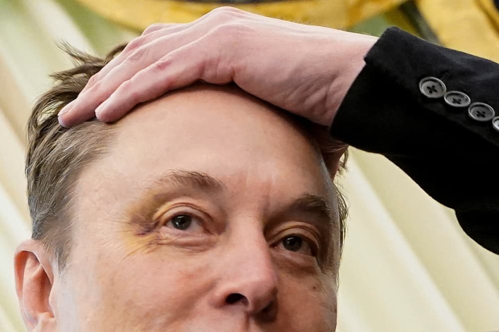 Elon Musk shows a bruised eye that Musk claimed he received at the hands of his son, X Æ A-12, as he attends a press conference with U.S. President Donald Trump in the Oval Office at the White House in Washington, D.C., U.S., May 30, 2025....